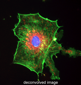 deconvolution microscopy tirevi fontanacountryinn com deconvolution microscopy