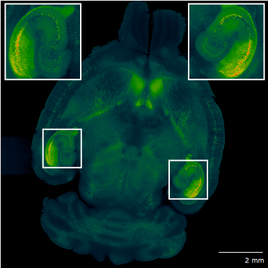 Mouse brain illuminated from both sides
