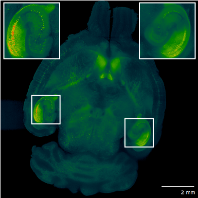 Mouse brain illuminated from the left side