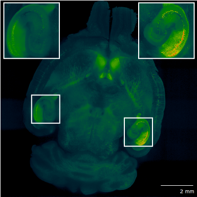 Mouse brain illuminated from the right side