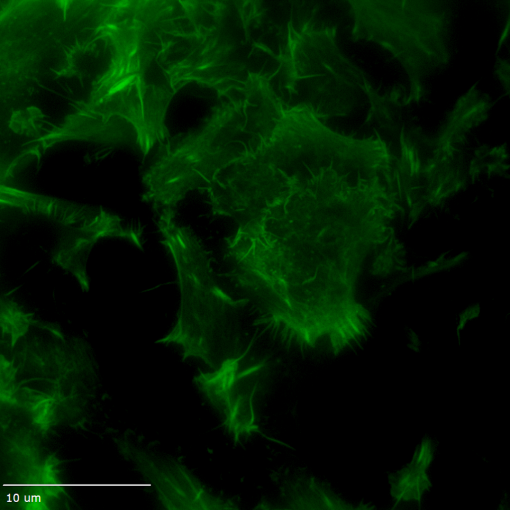 Total Internal Reflection Fluorescence (TIRF) Microscopy - 3i